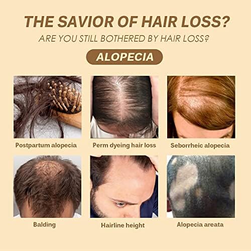 מרכיבים טבעיים לעזור בריא שיער צמיחה תיקון שיער אובדן להפוך שיער לגדול יותר מתאים לכל שיער סוגים ...