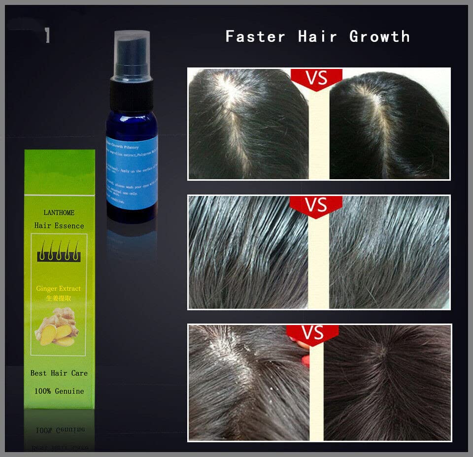 שיער אובדן טיפול טיפול לצמיחה מחודשת מהירה שיקום עיבוי להזין