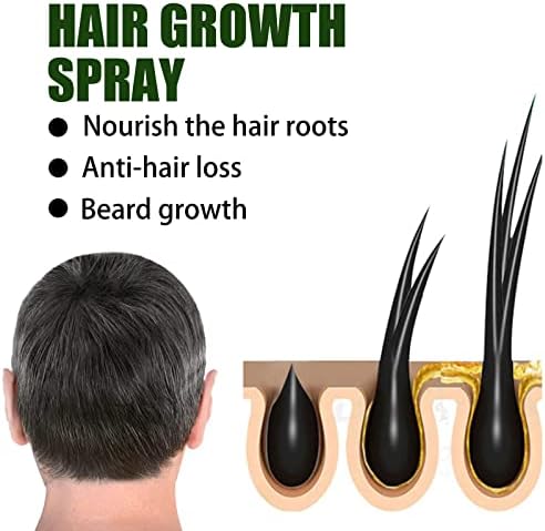 צמיחת שיער ספריי לגברים, נגד נשירת שיער סרום ספריי / סט של 2 / לצמיחה מחודשת שיער מזין ג ' ינג