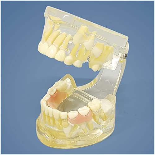 Kh66zky ruheng מודל שיניים לסירוגין, מודל שיני הפגנת שיניים, לחינוך, תקשורת מטופלים, למידה ומעבדה