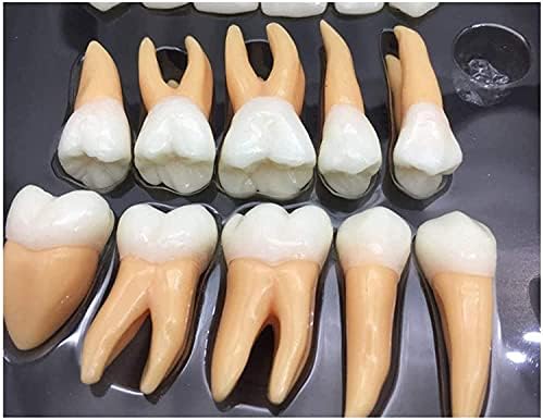 מודל שיני שיניים, פי 2.5 פעמים מודל שיניים קבוע של שני צבעים לחינוך, מודל הדגמת שיניים חולים תקשורת, למידה ומעבדה