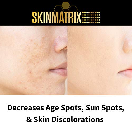מתקן כתם כהה-קרם התבהרות עור באופן טבעי נמוג כתמים וסימנים עבור פנים & מגבר; גוף. תיקוני גוון עור