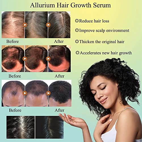 אלוריום שיער צמיחת סרום לנשים שחורות, 2023 חדש אלוריום שיער צמיחת סרום, אנטי שיער אובדן להזין יבש פגום שיער תיקון,
